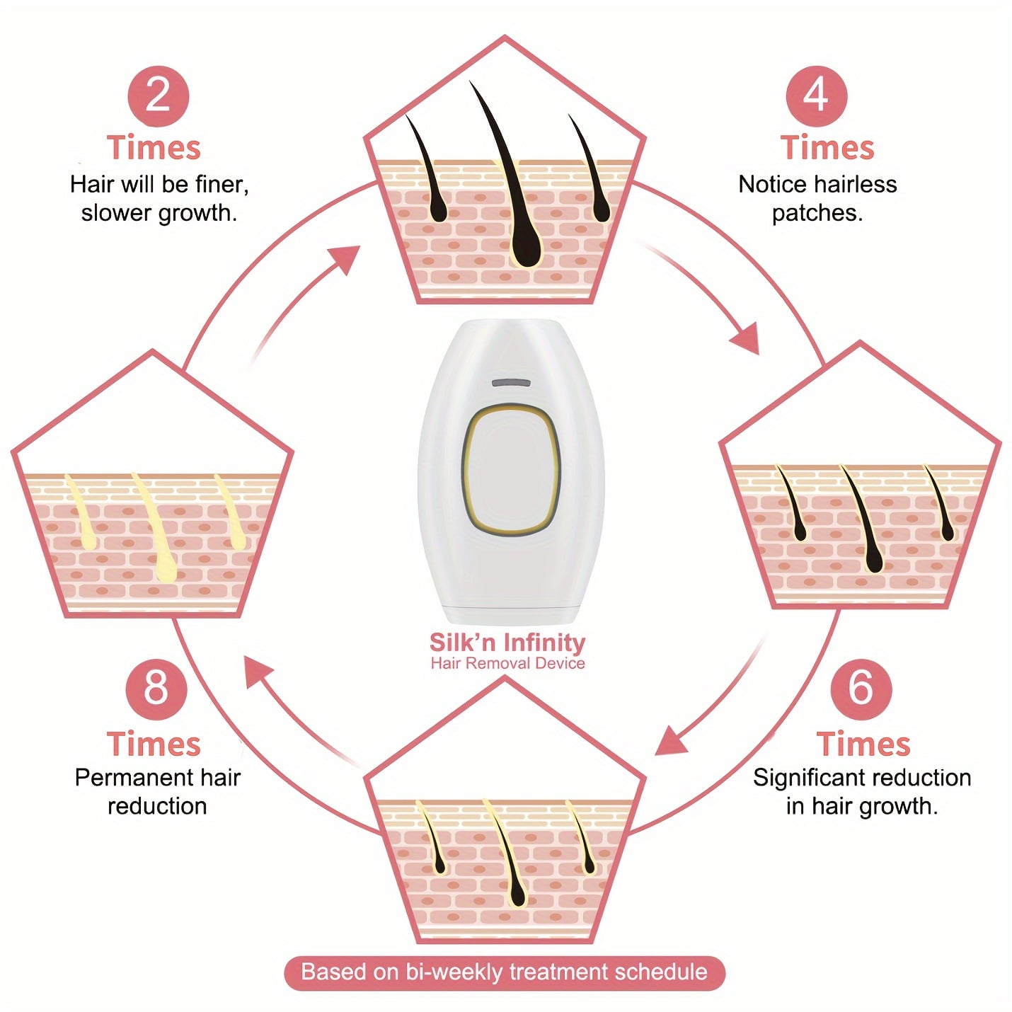 Portable IPL Painless Hair Removal Device For Home Use, Up To 999999 Flashes For Women And Men, Permanent Hair Removal On Armpits Back Legs Arms Face Bikini Line, Holiday Gift