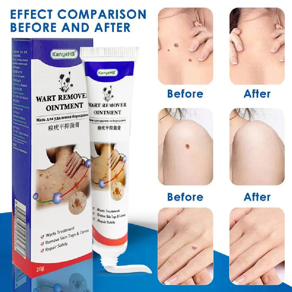 Mieauty Tag Skin Removal Cream Skin Care Cream,20G
