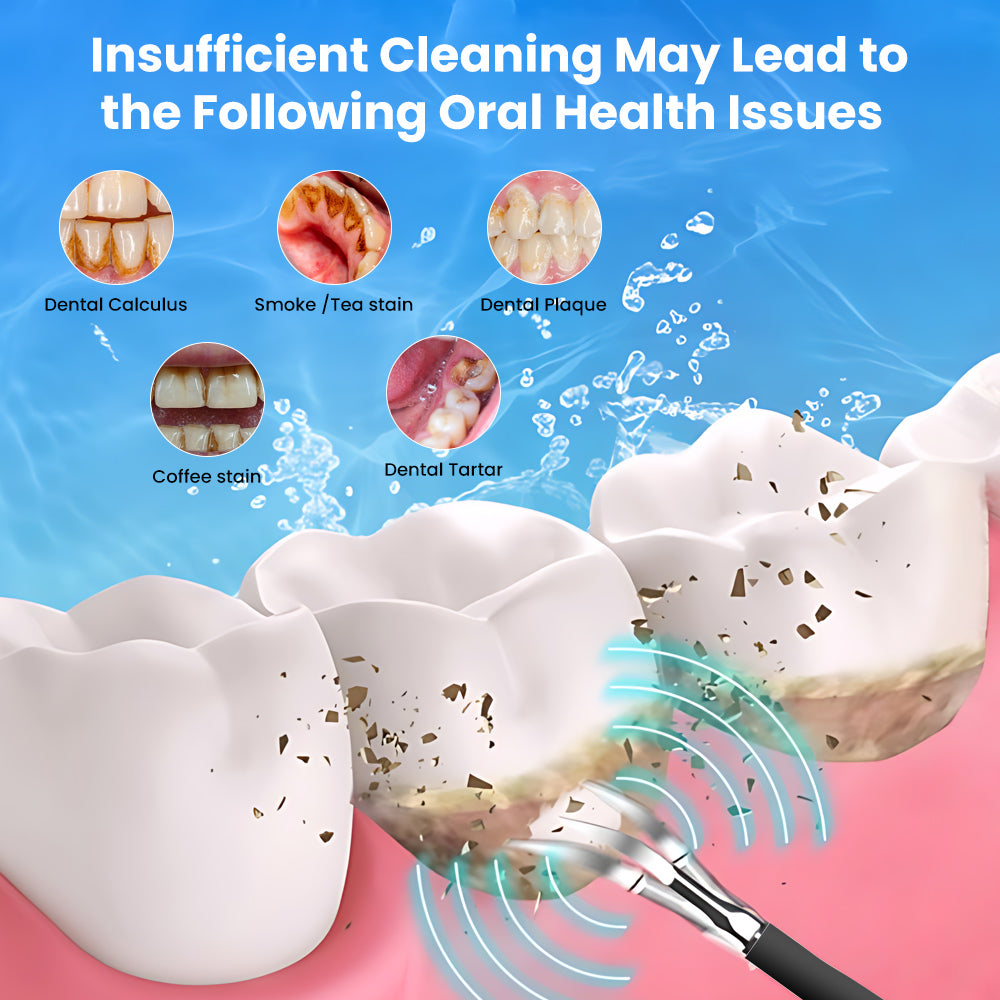 Mieauty 2 In1 Electric Ultrasonic Dental Calculus Remover with 5 Modes, IPX7 Waterproof Rechargeable High Frequency Vibration Electric Toothbrush for Travel & Home Teeth Cleaning Set & Whitening Kit