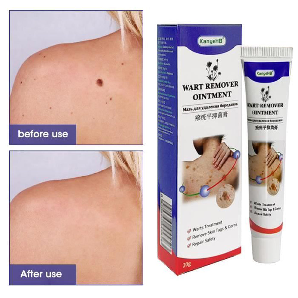 Mieauty Tag Skin Removal Cream Skin Care Cream,20G