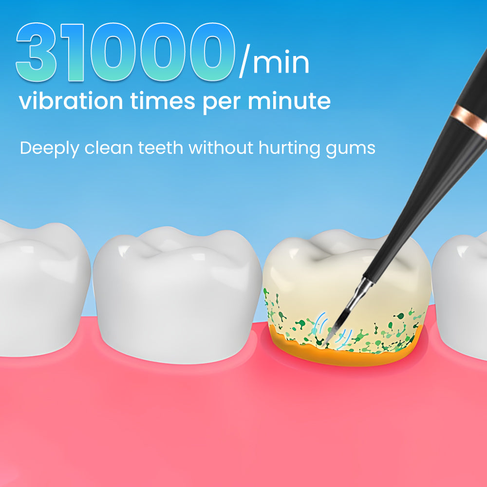 Mieauty 2 In1 Electric Ultrasonic Dental Calculus Remover with 5 Modes, IPX7 Waterproof Rechargeable High Frequency Vibration Electric Toothbrush for Travel & Home Teeth Cleaning Set & Whitening Kit