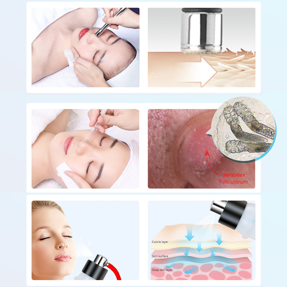 Mieauty 3 in 1 Diamond Microdermabrasion Machine Professional Facial Micro Dermabrasion Skin Care Peeling Blackheads Removal for Home & Salon Studio
