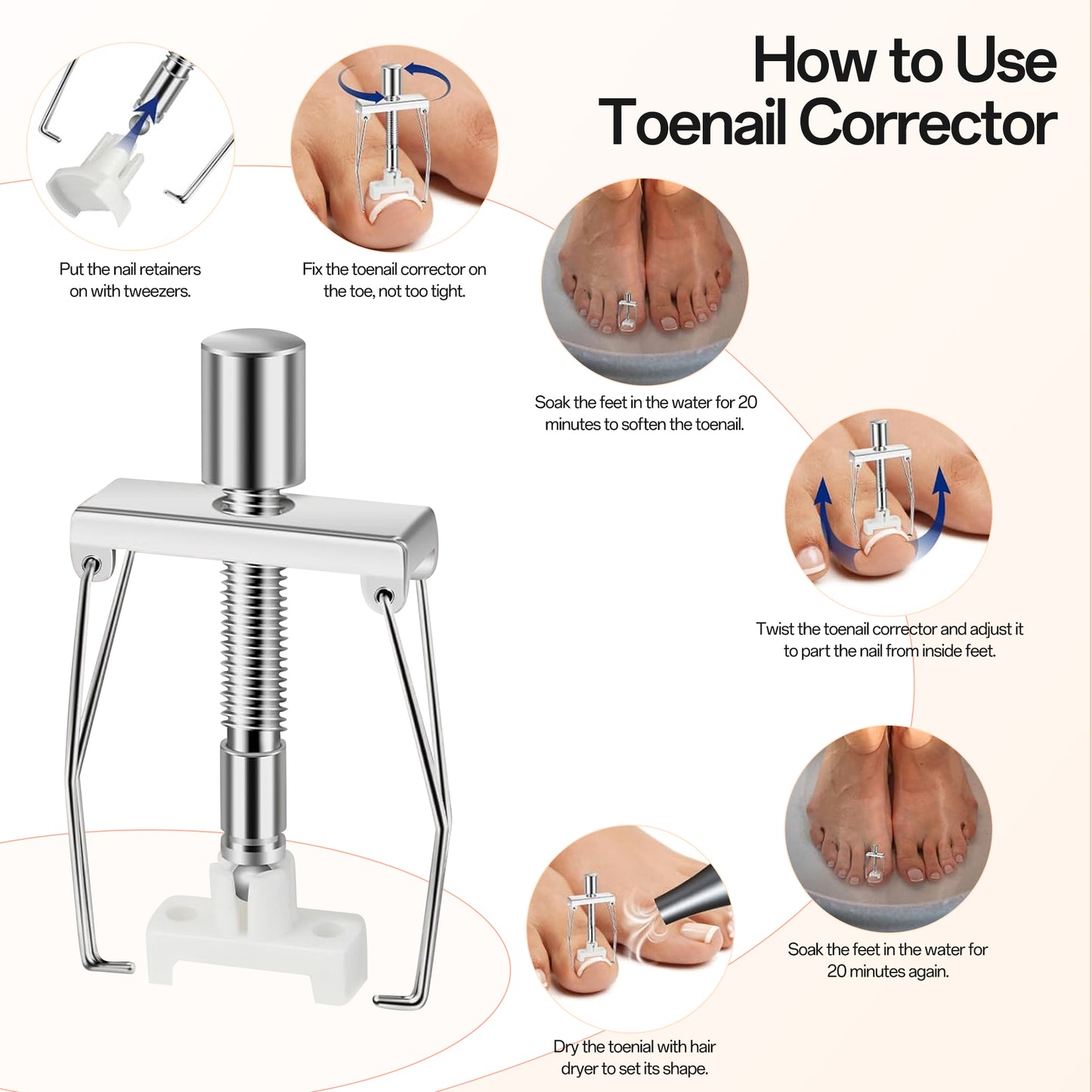 Ouwald Ingrown Toenail Treatment Tools, 84PCS Ingrown Toenail Removal Kit, Ingrown Toenail Corrector, Feet Nail Lift Pedicure Tool