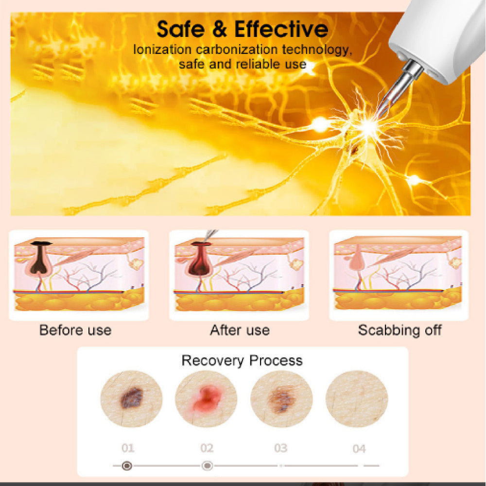 Ouwald Plasma Mole Removal Pen with 9 Modes Adjustment, Portable Freckle Wart Removal Pen Dark Remover For Face Tag Skin Care Blackhead Removers, Rose Gold