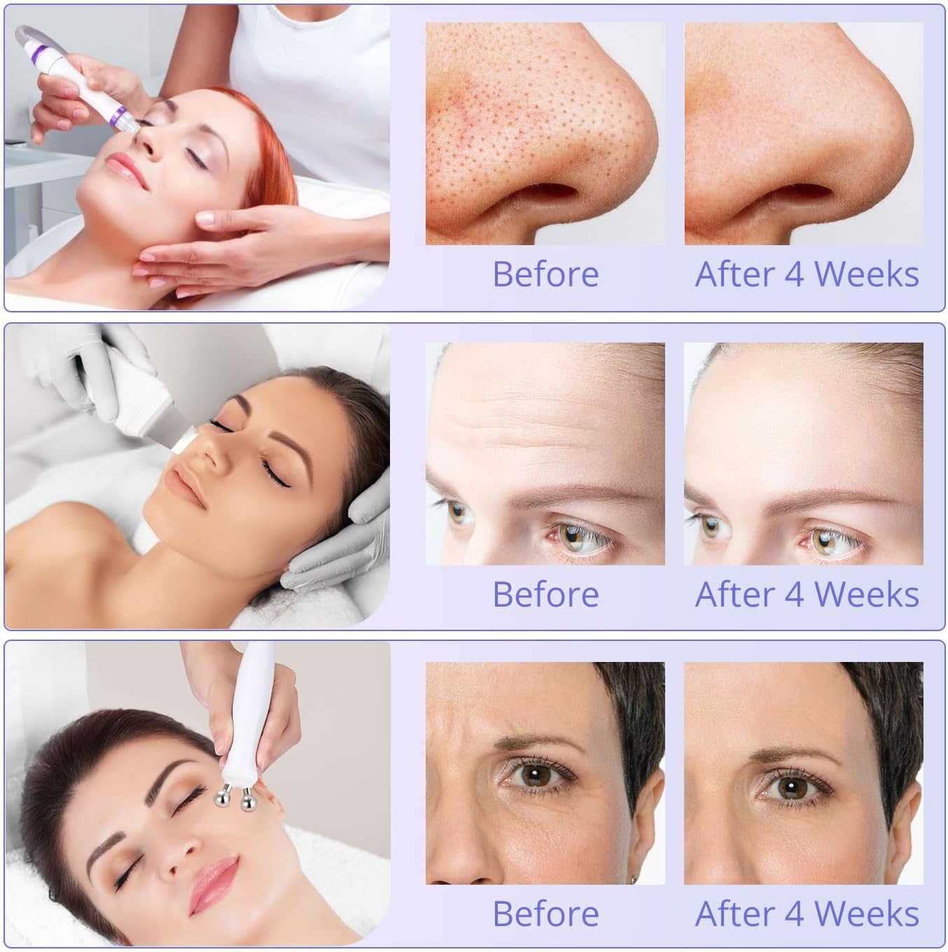 Mieauty Hydro-Facial Machine 6 in 1 Multifunctional Hydrogen Oxygen Facial Hydro Machine Microcurrent Hot Cold Skin Care Hydro-Dermabrasion Facial Microdermabrasion Beauty Machine Blackhead Remove