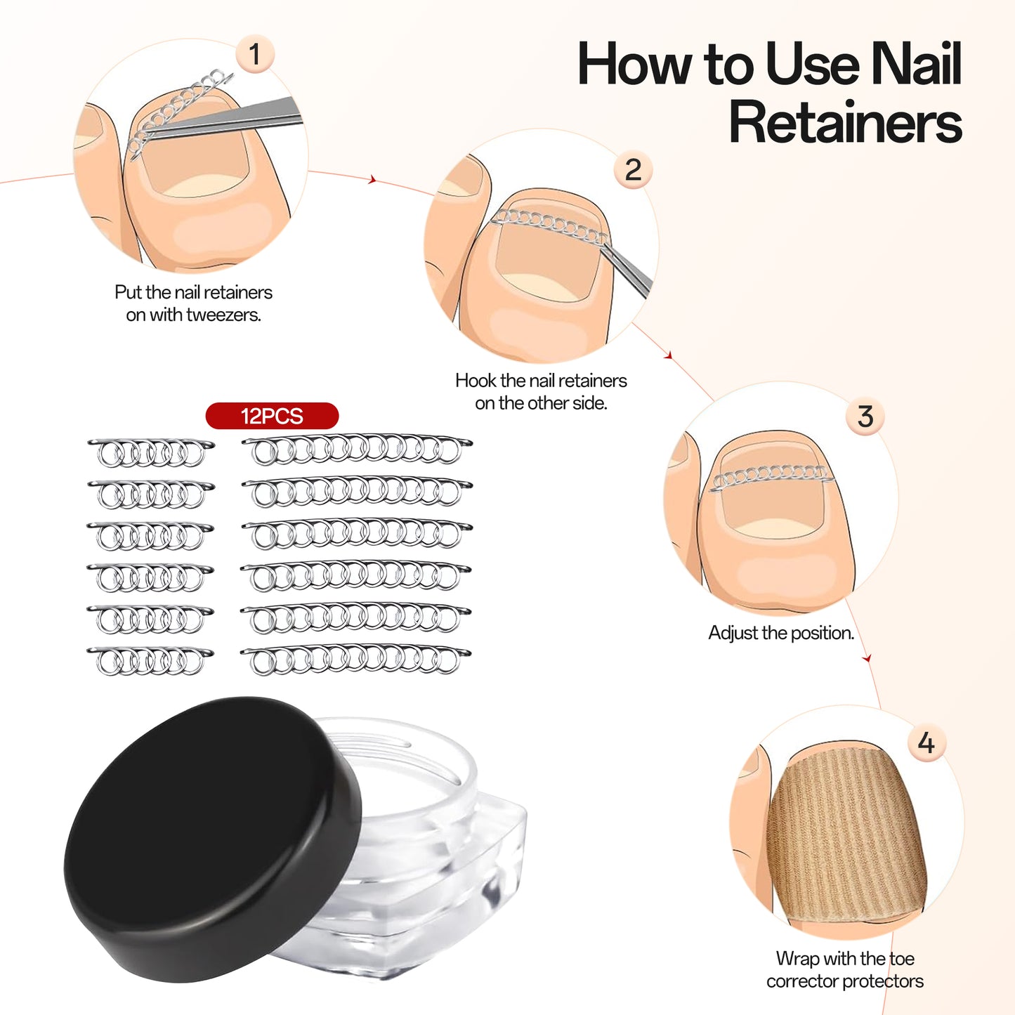 Ouwald Ingrown Toenail Treatment Tools, 84PCS Ingrown Toenail Removal Kit, Ingrown Toenail Corrector, Feet Nail Lift Pedicure Tool