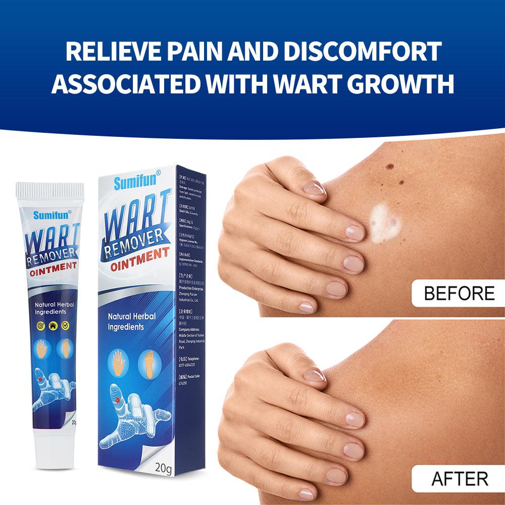 Mieauty Wart Remover Fast Remove All Moles Warts Spots Freckles Foot Corn Removal Warts Papillomas Rapidly Remove Moles, 20G Wart Cream