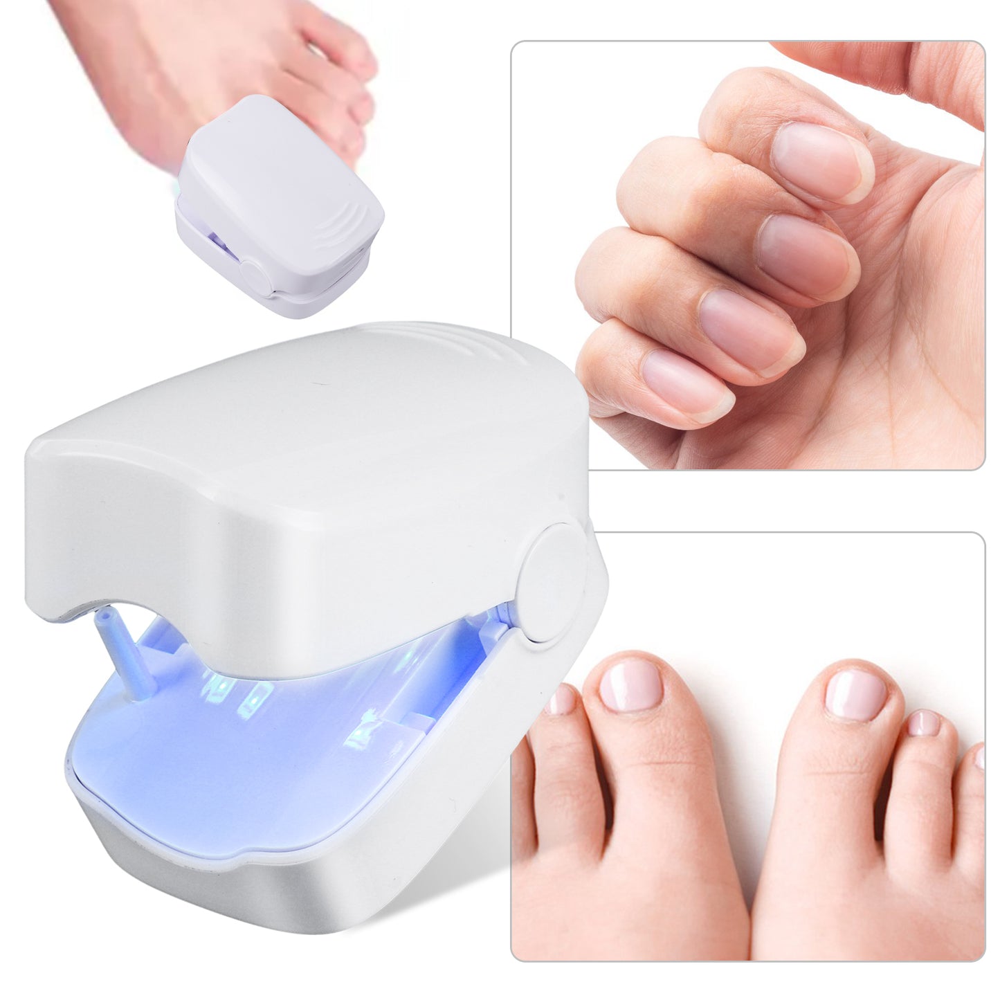Mieauty Nail Fungus Cleaning Laser Device, Nail Fungus Laser Treatment for Damaged Discolored Thick Toenails & Fingernails, Rechargeable Nail Fungus Remover for Home Use