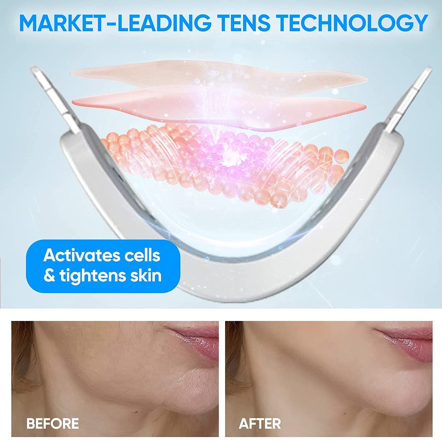 Mieauty Double Chin Reducer Machine, Electric Face Lift Device Beauty Belt, Portable Intelligent V-Face Shaping Massager with Blue Light,White