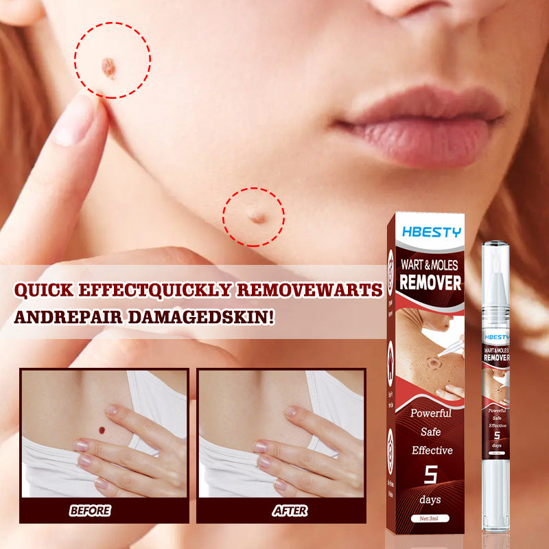 Mieauty Fast Effectively Warts-Off Removes Moles and Skin Labels Without Leaving Scars| Natural Repair Essence
