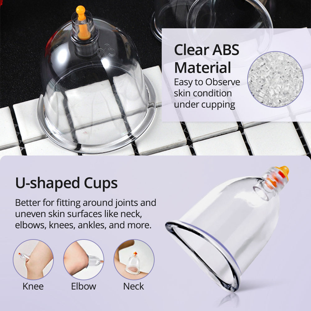 Ouwald Cupping Set for Massage Therapy - 22 Cups Chinese Cupping Kit with Hand Pump