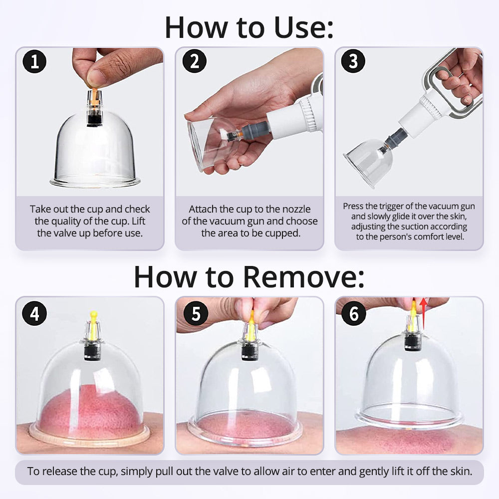 Ouwald Cupping Set for Massage Therapy - 22 Cups Chinese Cupping Kit with Hand Pump