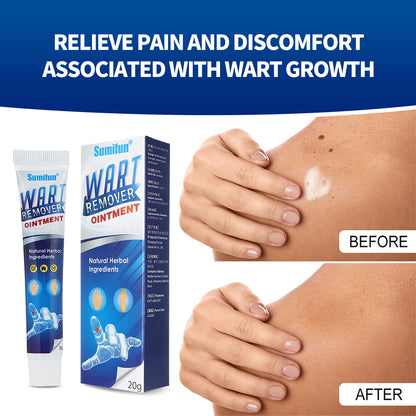 Mieauty Wart Remover Fast Remove All Moles Warts Spots Freckles Foot Corn Removal Warts Papillomas Rapidly Remove Moles, 20G Wart Cream