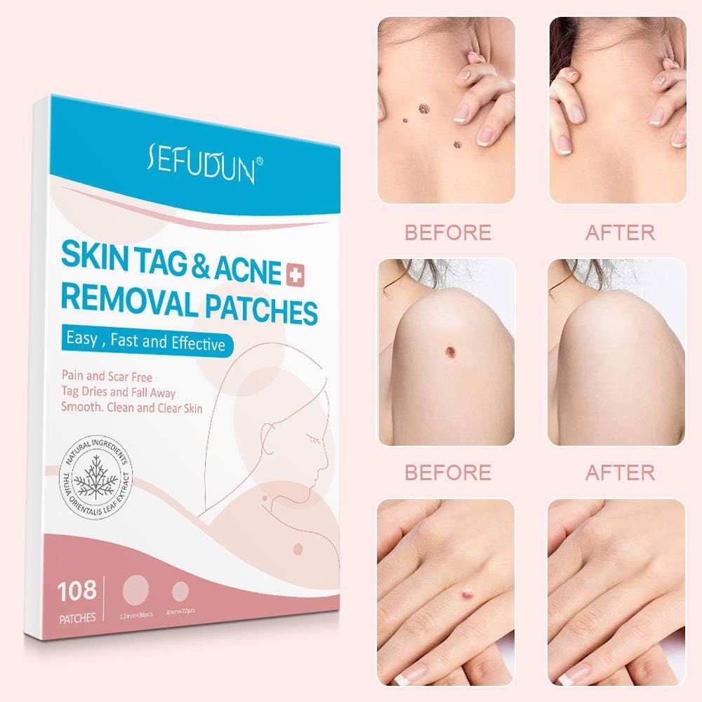 Mieauty Ingredients And Effective Remover Tag 108PCS Removal Tag And Skin Improved Patch